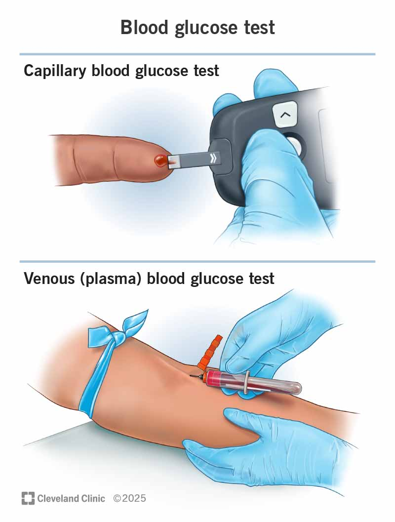 99% Blood Glucose (Sugar)98% of people with diabetes don’t even know about a simple an…99% Blood Glucose (Sugar)